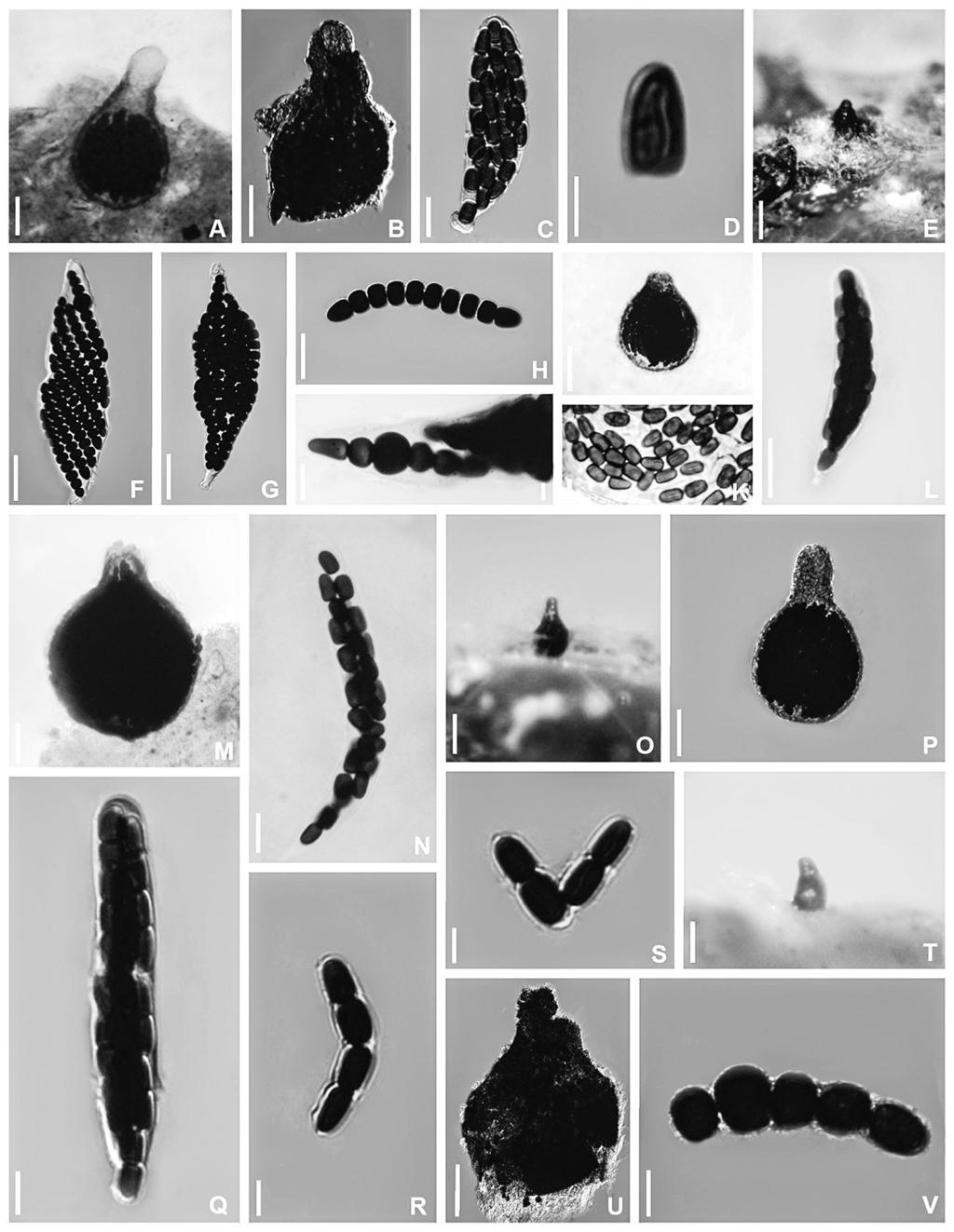 Sporormiella longicolla sp. nov. (Brazil)... 465 Fig. 1. Sporormiella species recorded on herbivore dung from Brazil. S. australis (URM86773): A. pseudothecium on dung; B.