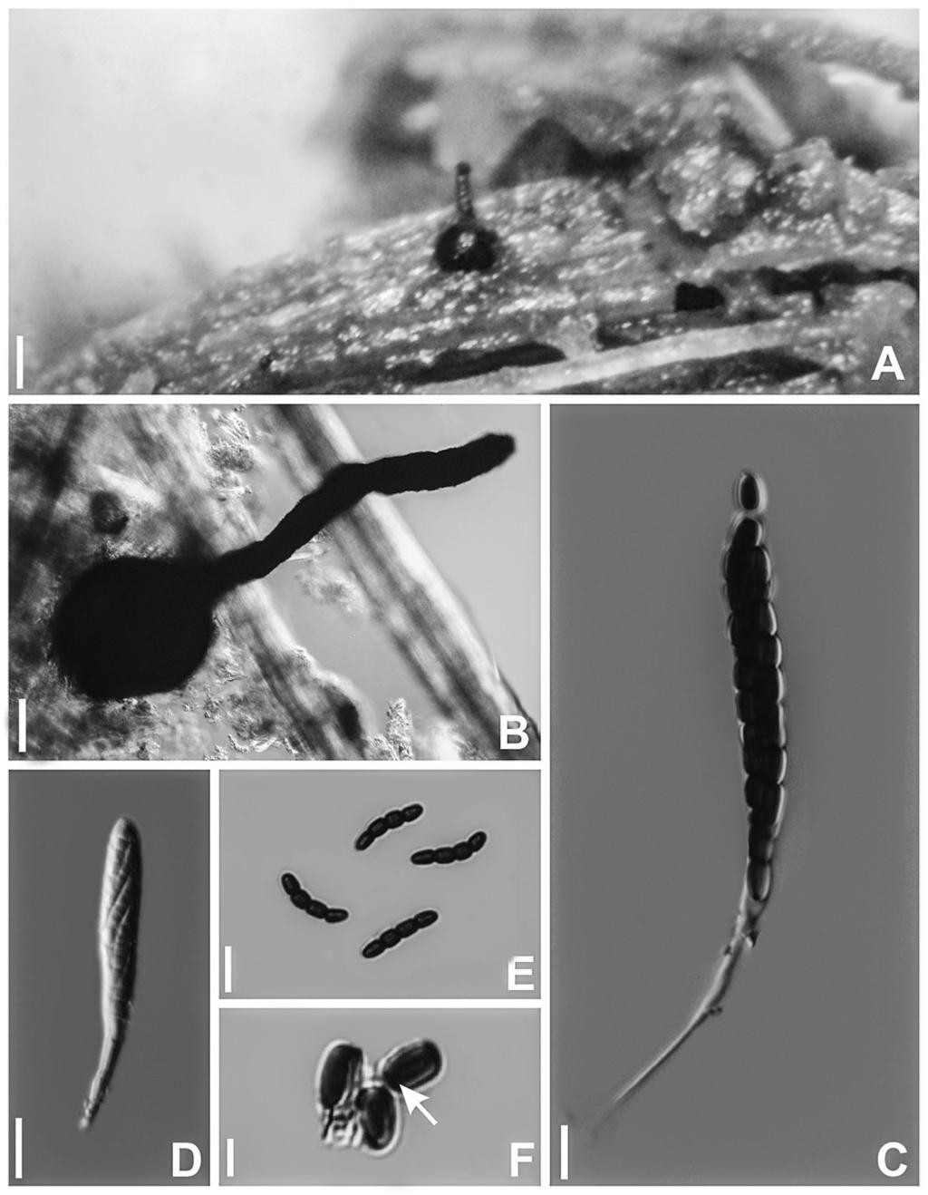 466... Melo, Miller & Maia Fig. 2. Sporormiella longicolla (holotype, URM87584): A. pseudothecium on dung; B. pseudothecium in mountant; C. mature ascus; D. young ascus; E.