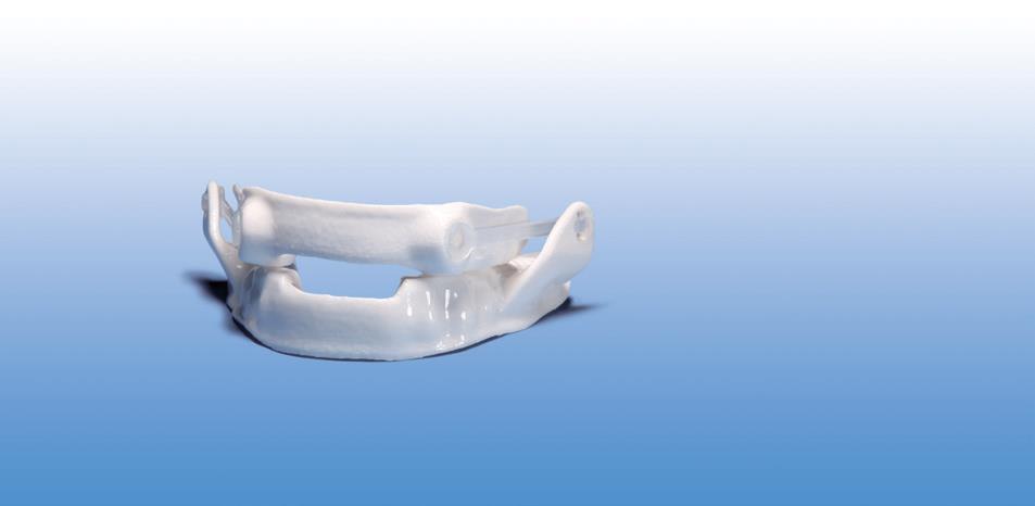 Narval CC Features The first and only CAD/CAM solution on the market o o o Computer-aided design (CAD) enables a high degree of customization to suit the complex dental anatomy of individual patients