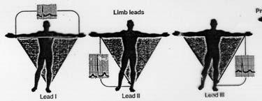 Leads I, II, III Normal 12-Lead