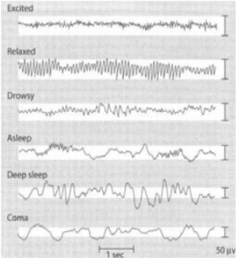 88-89) Psychophysiological Assessment Assess brain structure, function, and activity of nervous system Methods Electroencephalogram (EEG): Brain wave activity (+1) Heart rate and respiration: