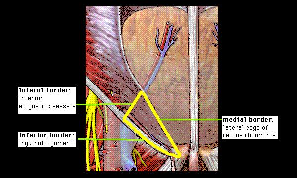 Inguinal triangle - Region of abdominal wall Borders