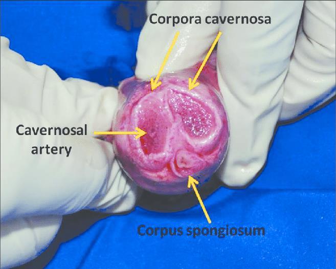 B- The corpus spongiosum It is median and lies in the ventral surface of the two corpora cavernosa.
