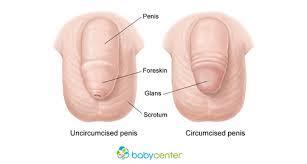 Circumcision is the