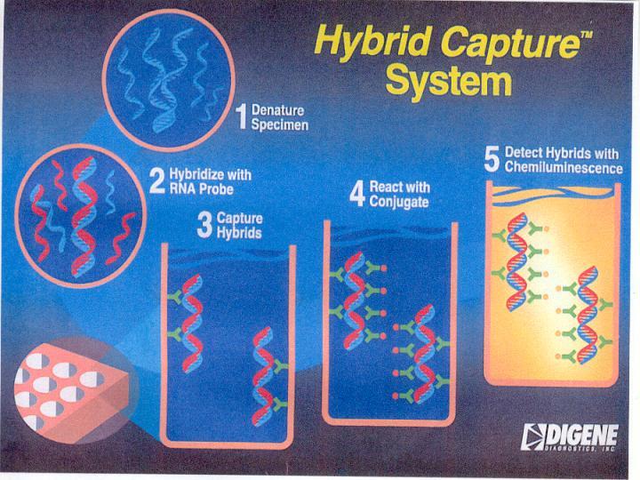 Qiagen Hybrid Capture for HR-HPV DNA detection 2. Rapid Capture System - 1.
