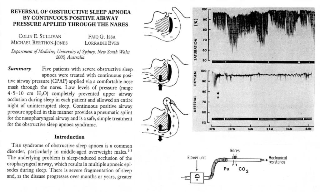 Sullivan s first description of nasal continuous positive airway pressure treatment for obstructive sleep apnoea, Lancet