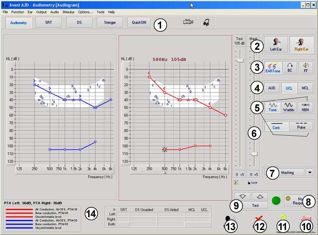 Performing Audiometric Testing The screen shot below shows the controls which are available from the Audiometer main window.