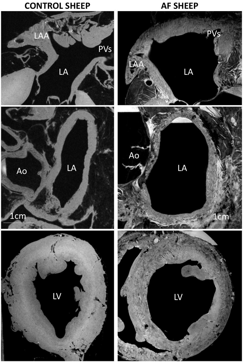 in ctl. Conclusion: High-field MRI reveals early atrial and ventricular structural remodeling in a sheep model of persistent AF.