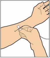 Step 2 Apply a tourniquet and clean the skin area where you will perform the infusion using an alcohol wipe.