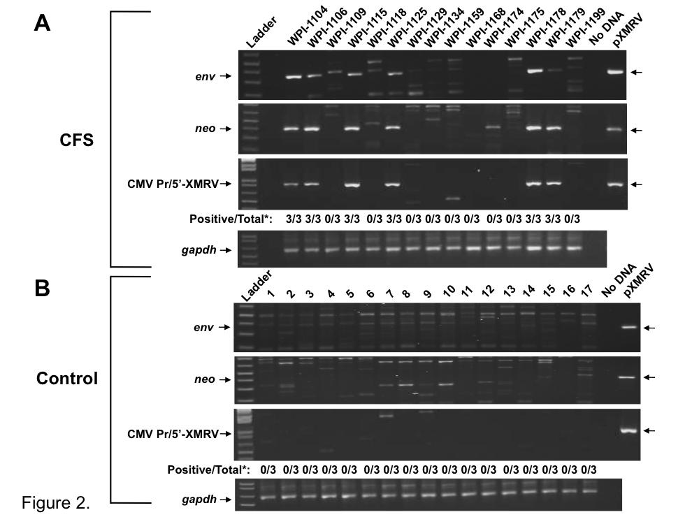Figure 2. XMRV and plasmid sequences in PBMC DNA from CFS patients.