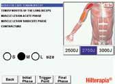 Hilterapia : why it is Unique. Thanks to a specific patented impulse, Hilterapia reaches very high peak powers (1-3 kw) with a pulsed Nd:YAG source (wavelength 1064 nm).