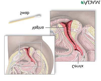 What is a Pap smear? A Pap smear is a test that checks for changes in the cells of your cervix.