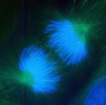 Lung cells