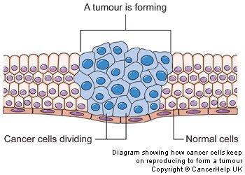 Abnormal Cell Cycle: Cancer Cancer is the uncontrolled growth and division