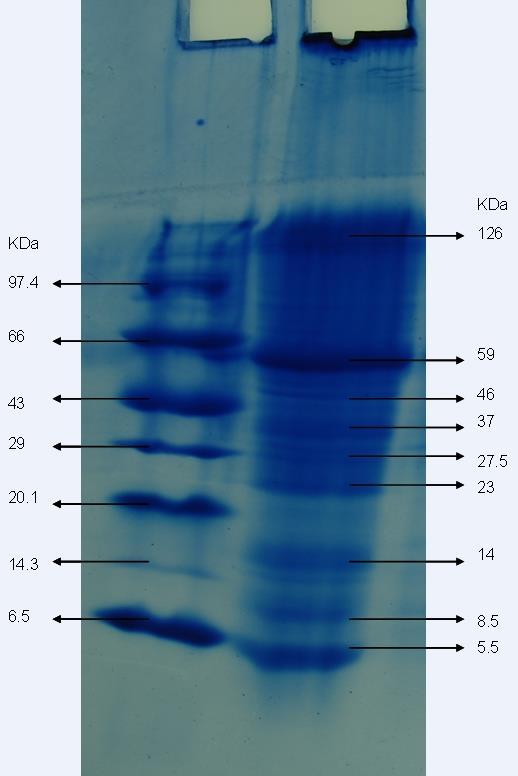 Figure 7: SDS-PAGE electrophoresis results of aqueous extract of Melia azedarach Lane 1 - shows the marker protein bands with their molecular weight ranging 6.50 97.4 kda.