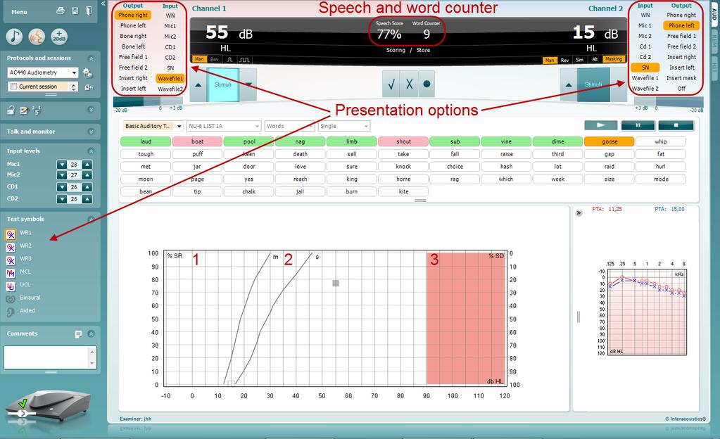 1.5.1 Speech Audiometry in Graph Mode Graph mode presentation settings in the lower left corner and in the presentation options (Ch1 and Ch2) in the upper part of the screen you can adjust the test