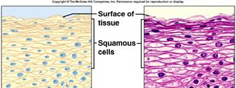Stratified squamous many cell layers top cells are flat can