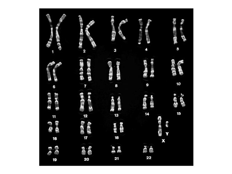 Reproductive System The differences between males and females are genetically determined and are obviously apparent in the karyotype of an individual.
