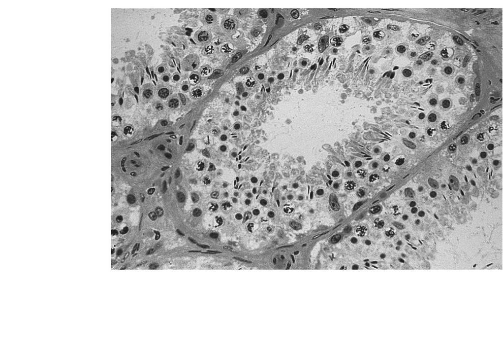 cells Areolar connective tissue Myoid cells