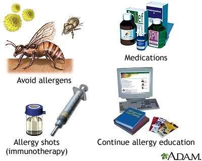 Allergic Rhinitis - Management Avoid allergens Antihistamines