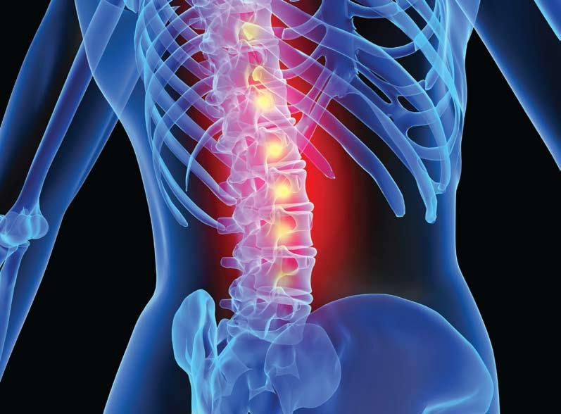 Back pain treatment and surgery London Bridge Hospital s Orthopaedic Consultants employ the latest technology and have been providing back pain relief through various techniques and surgeries for
