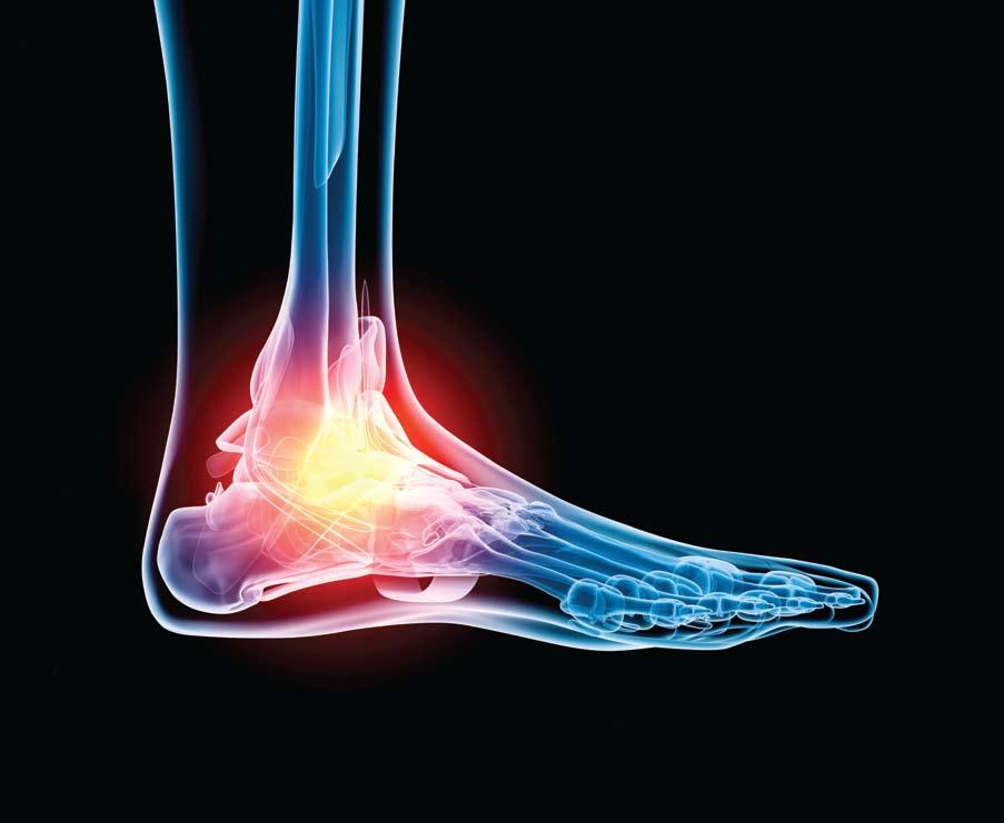 Foot and ankle treatment and surgery At London Bridge Hospital, we have leading Consultants that specialise in treating a large variety of foot and ankle problems, such as sports injuries, fractures,