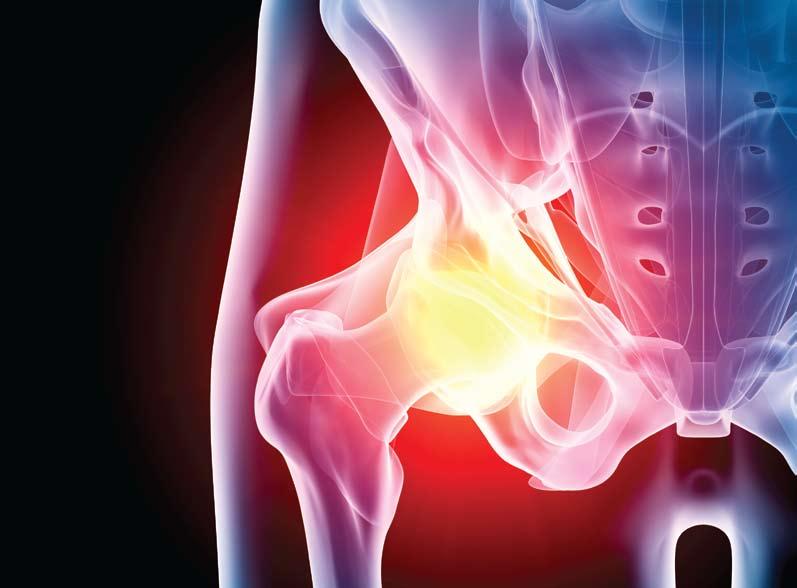 Hip treatment and surgery A hip procedure can be a complicated surgery to undertake. At London Bridge Hospital, we have many years experience in this specific orthopaedic specialty.