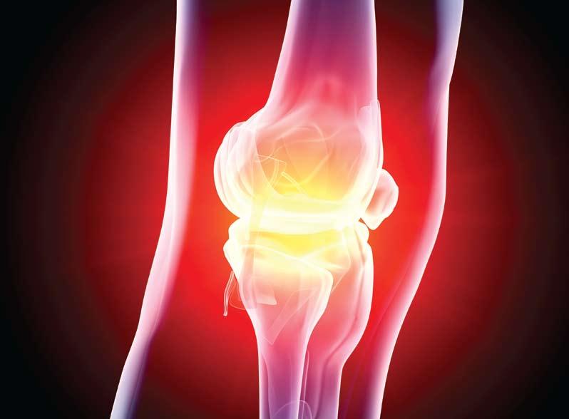 Knee treatment and surgery London Bridge Hospital provides a highly specialised service for the rapid diagnosis and treatment of knee pain, knee injuries and other knee problems.