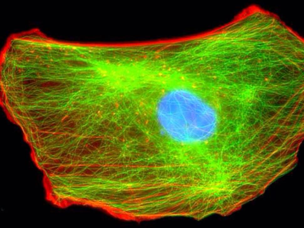 Made of microtubules and microfilaments that provide structure and shape for the cell.