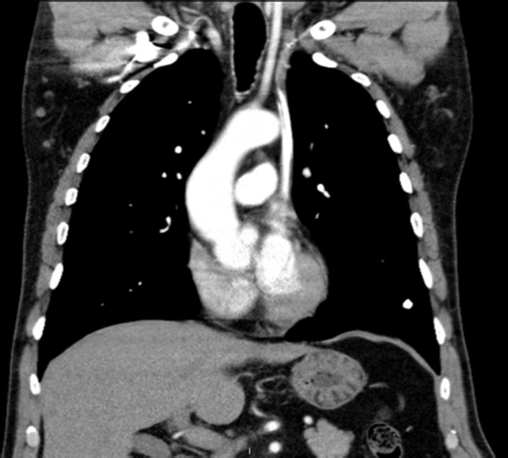 Fig. 6: 54 years-old male patient with a left