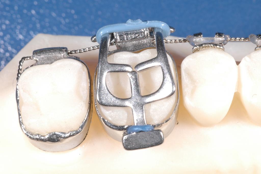 and the occlusal initial views of the patient