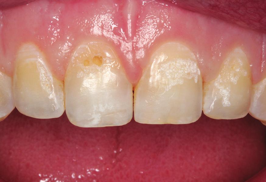 Summary Teeth are comprised of different components.