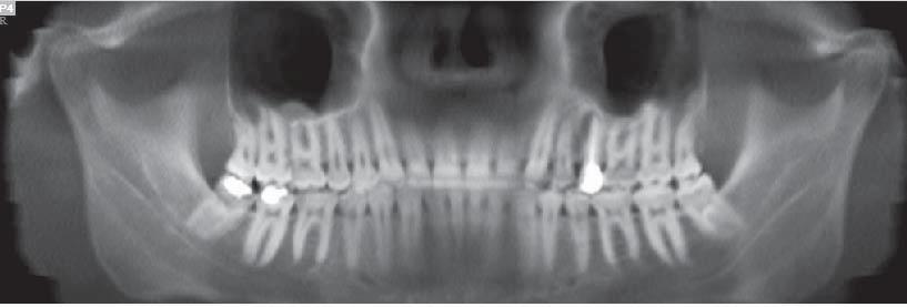 Endodontics Figure 1 demonstrates residual It is common to expect two roots and periapical