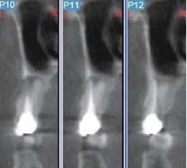 Figure 1 Figure 2 Figure 3 joint space (Figure 1), arthritis (Figure 1) and pathology.