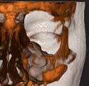 inclination, position of NNT gathers any combination impacted and supernumerary of images onto one screen teeth, resorption,