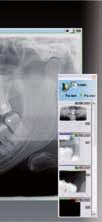 The cephalometric option extends the capabilities from the Imax Touch / 3D by acquiring x-rays from the skull and carpus.