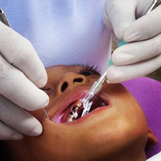 children have dental caries, with
