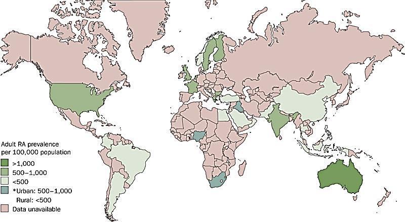 Prevalence of RA Worldwise prevalence 0.5-1.