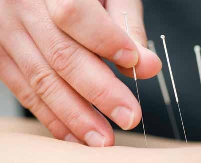 Complementary Health Services Acupuncture Acupuncture is based on the natural laws that describe the movement of life energy, or Qi, in nature and in the body.