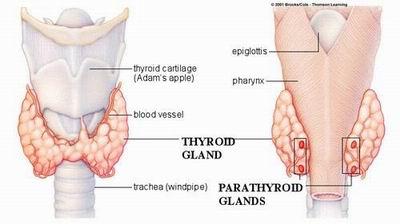 Hypoparathyroidism Complication of thyroid surgery Injury to parathyroid glands Results in