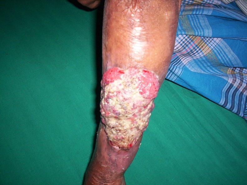 Question 2: Can you name the lesion?