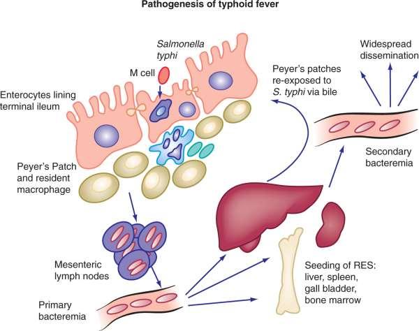 PATHOGENESIS Hyperplasia of peyers patches Necrosis & ulcer formation Hyperemia and focal