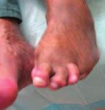 Please continue to check your feet every day for any changes or signs of injury.