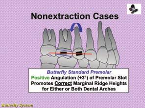 nonextraction and extraction treatment options (solid