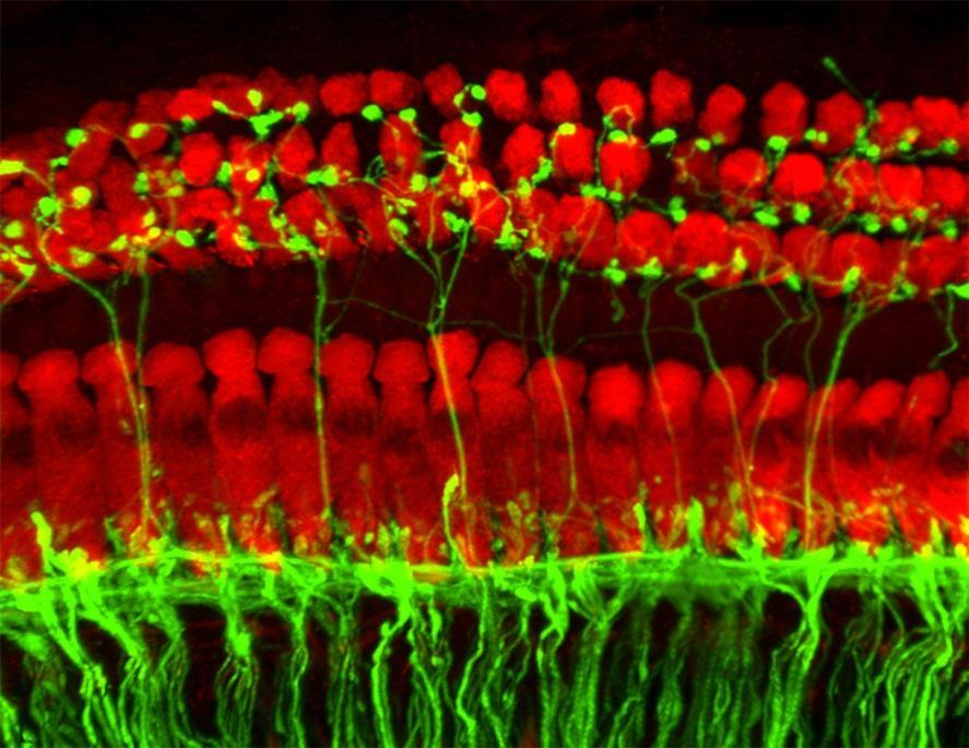 Content Physiology, anatomy Nano-Mechanics of inner ear Inner hair cells