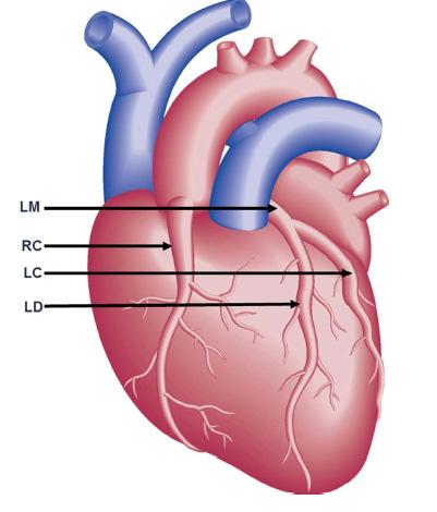 arteries: - LM Left main coronary artery - RI