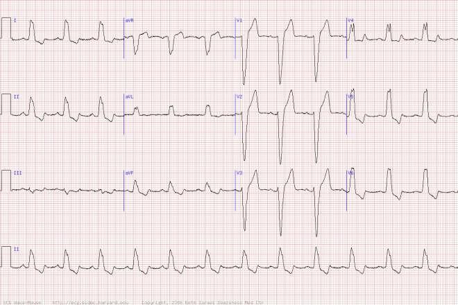 50 year old healthy banker presenting for routine medical check. Asymptomatic.