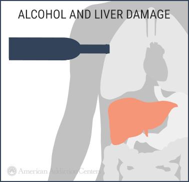 ALCOHOL AND THE LIVER Alcohol (ethanol) is considered a toxin to the body it is the