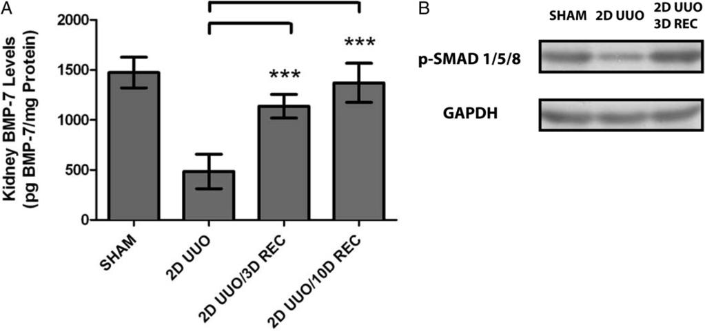2526 BMP-7 SMAD1/5/8 PATHWAY PROMOTES KIDNEY REPAIR AFTER INJURY Figure 3. BMP-7 Smad1/5/8 pathway was activated during renal recovery (REC) after UUO induced renal injury.