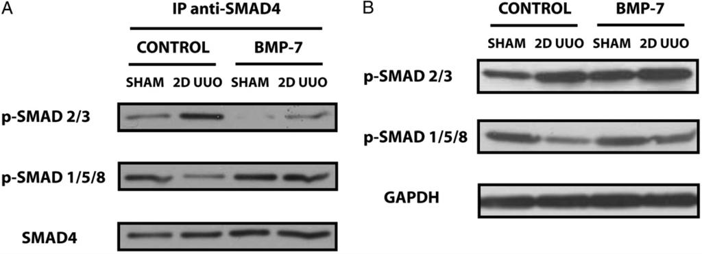 BMP-7 SMAD1/5/8 PATHWAY PROMOTES KIDNEY REPAIR AFTER INJURY 2527 Figure 5. BMP-7 Smad1/5/8 pathway suppressed formation of TGF- dependent Smad4 transcription factor complexes.